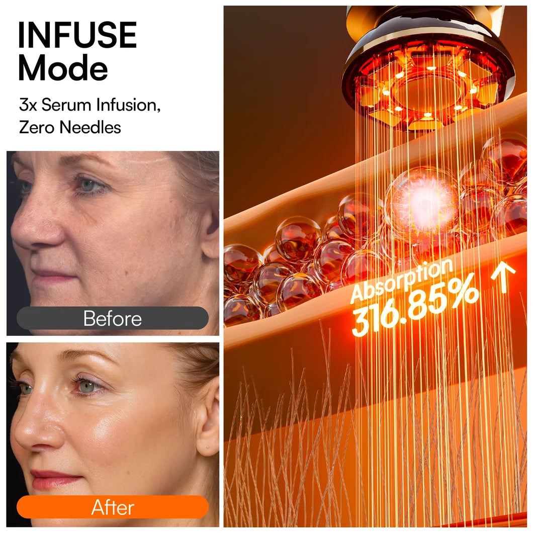 FLARE Microcurrent Facial Device