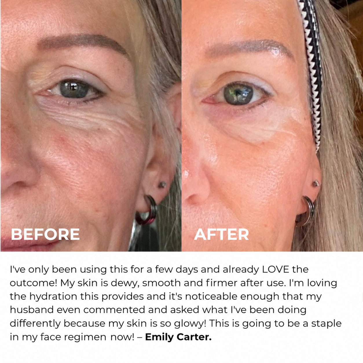 Smoother, Younger-Looking Skin Starts Here