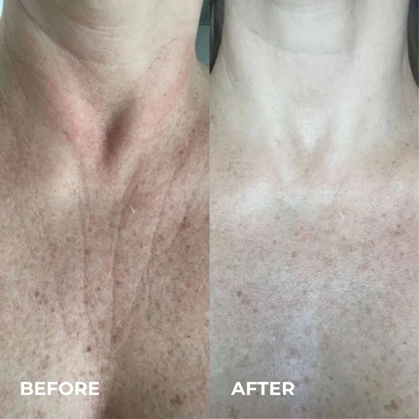 Smoother, Younger-Looking Skin Starts Here
