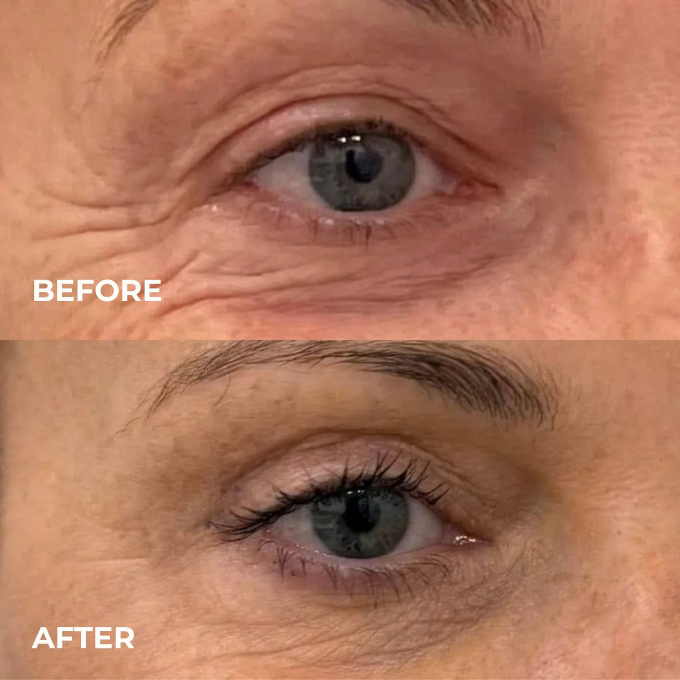 Smoother, Younger-Looking Skin Starts Here