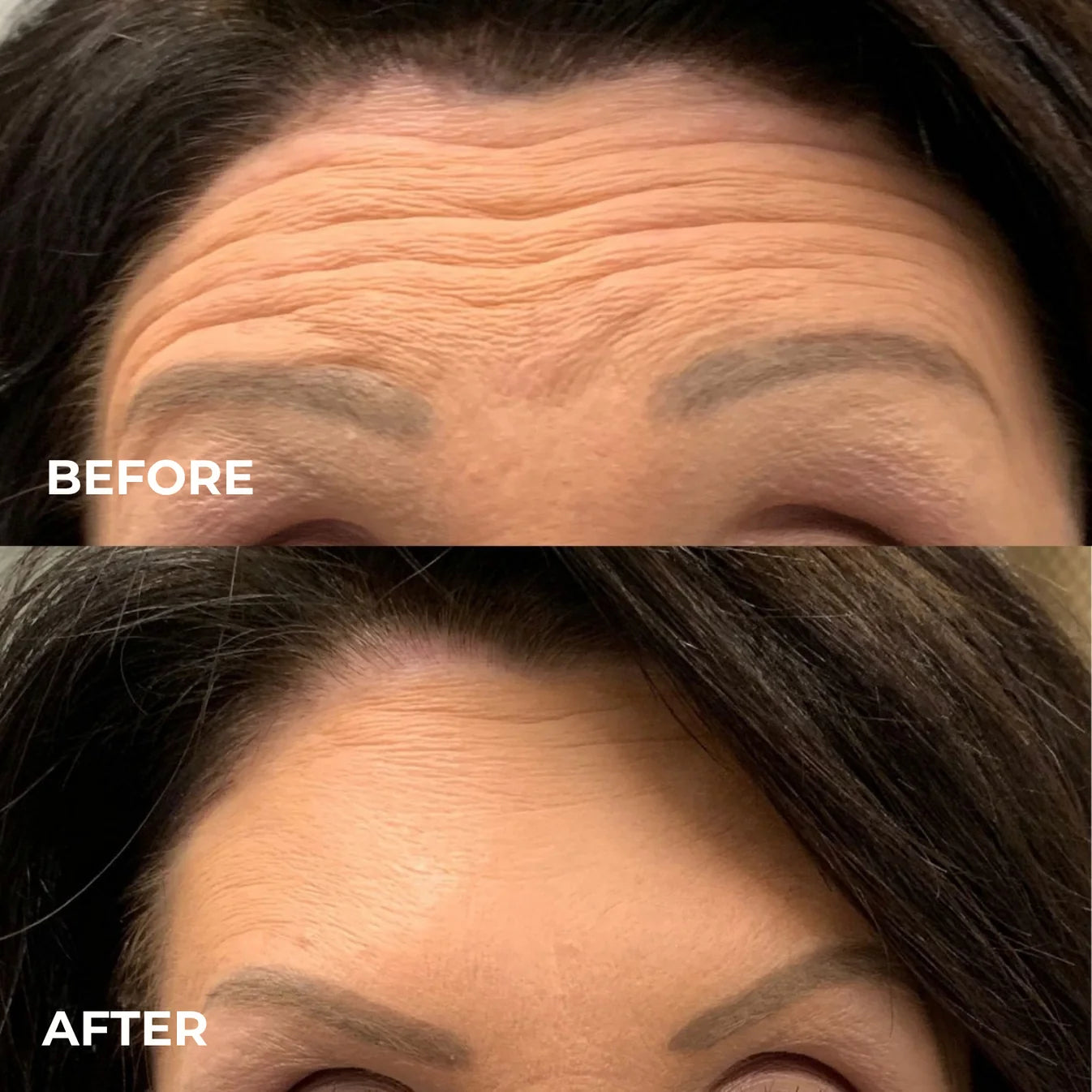 Smoother, Younger-Looking Skin Starts Here