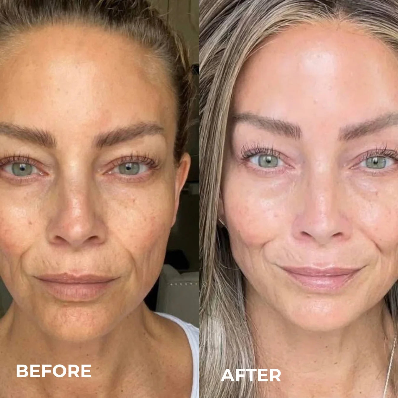 Smoother, Younger-Looking Skin Starts Here