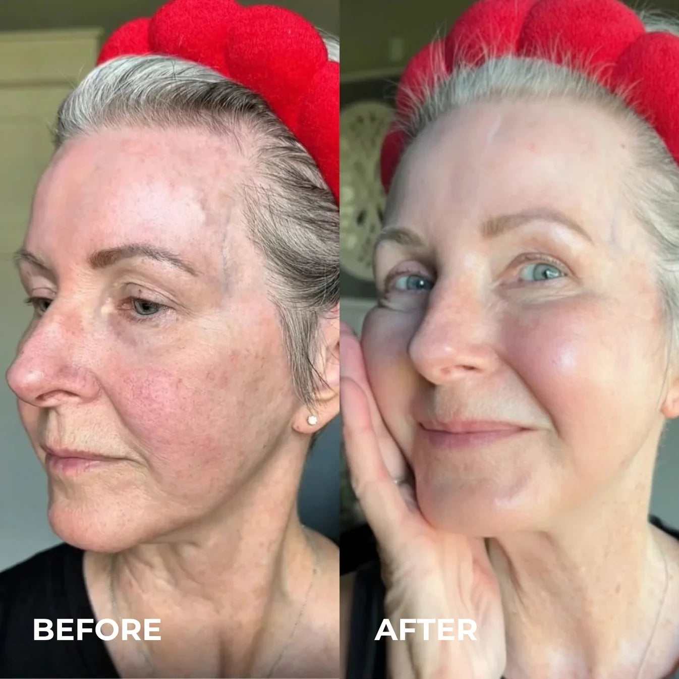 Smoother, Younger-Looking Skin Starts Here