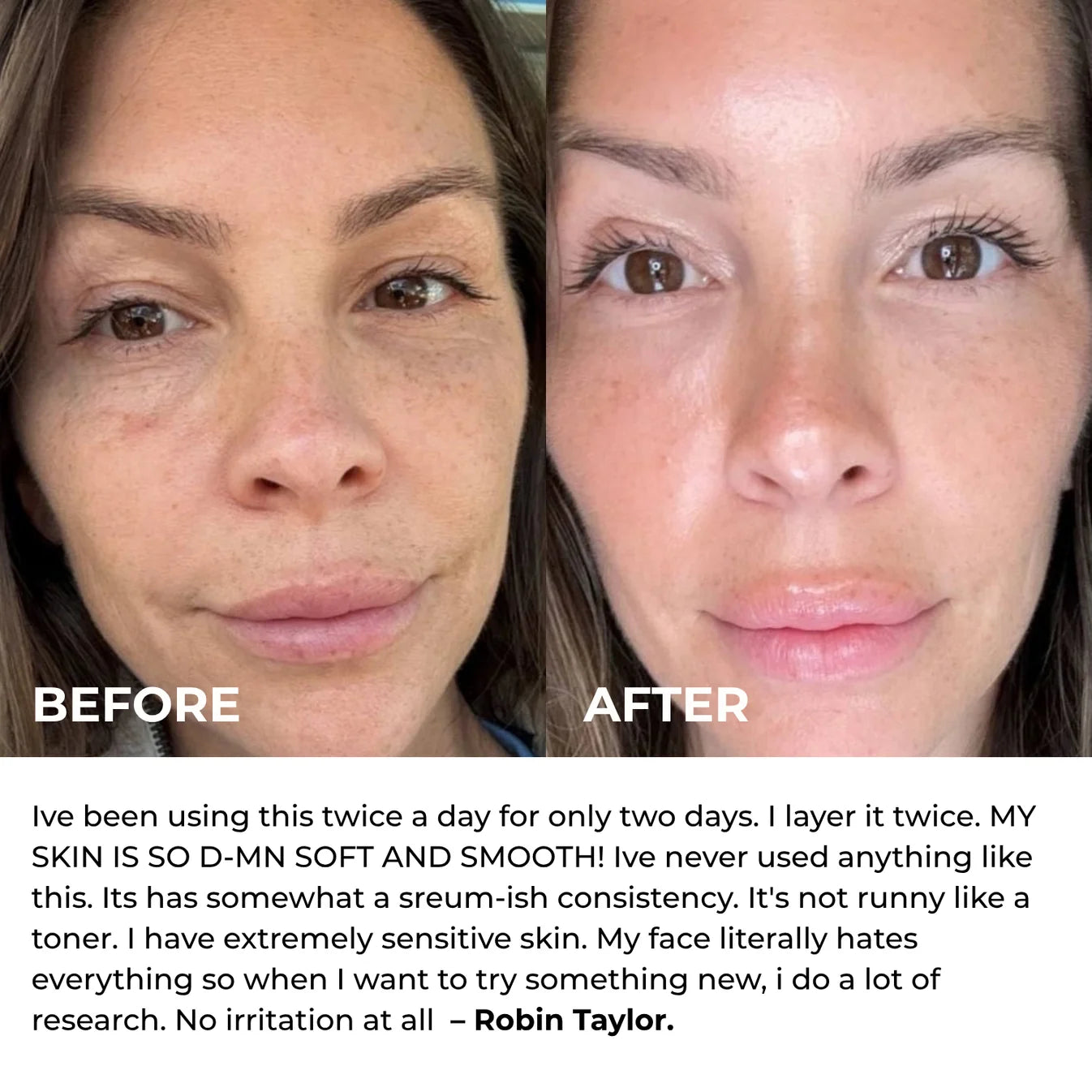 Smoother, Younger-Looking Skin Starts Here